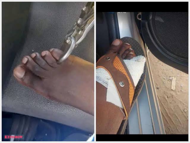Zimbabwean citizens reportedly being forced to cut and sell off their toes due to the bad economy [Photos/Video]