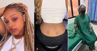 Lady Hospitalized After Getting A Back Dimple Piercing – Photo