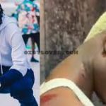 Mohbad reveals his truth; gives full account of alleged assault as he accuses Naira Marley for coordinating the attack